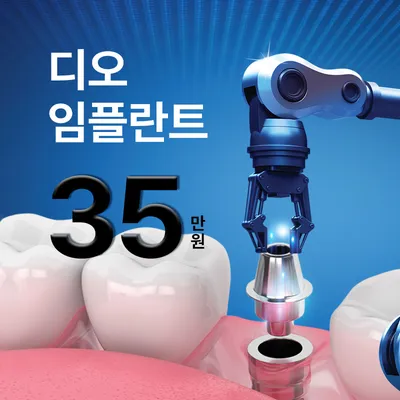 ★디오 임플란트 35만원★ 이벤트 썸네일 이미지