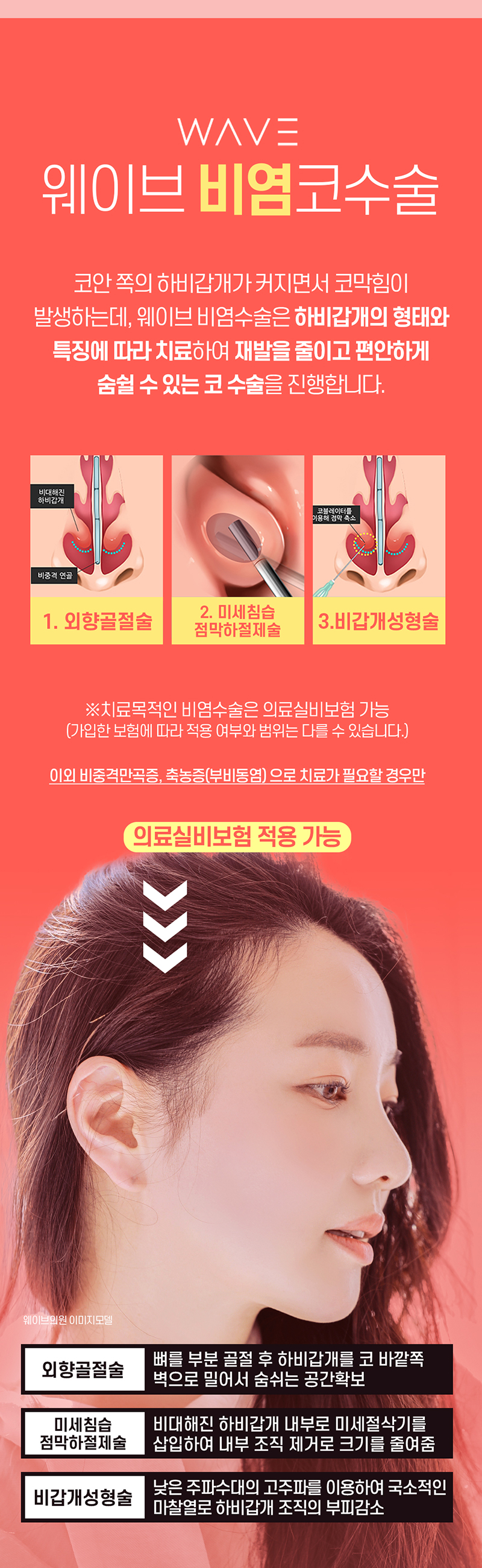 웨이브의원 웨이브 😪비염코성형😪 이벤트, 시술 상세 이미지