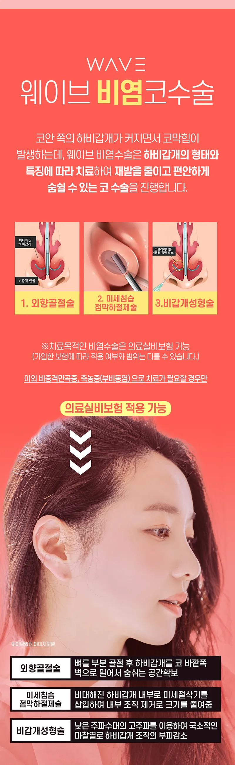 웨이브의원 웨이브 😪비염코성형😪 이벤트, 시술 상세 이미지