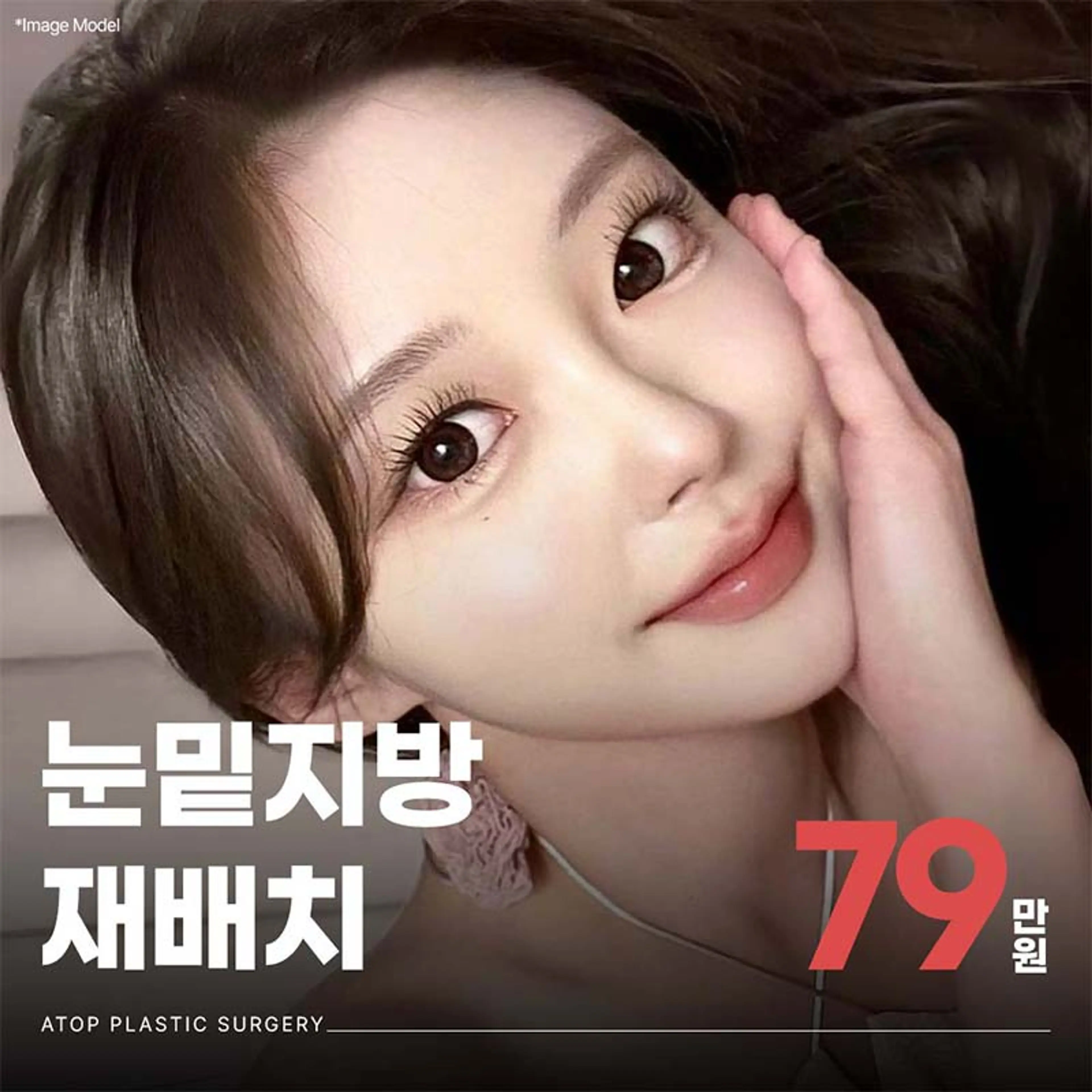 에이탑 눈밑지방재배치 