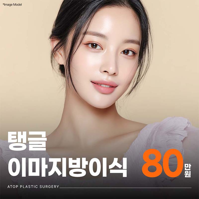 에이탑 탱글 이마지방이식 이벤트 썸네일 이미지