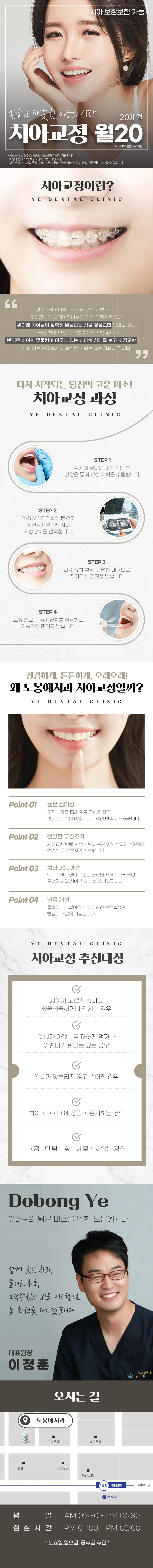 서울리즈치과의원 도봉예치과_치아교정 월분납 이벤트, 시술 상세 이미지