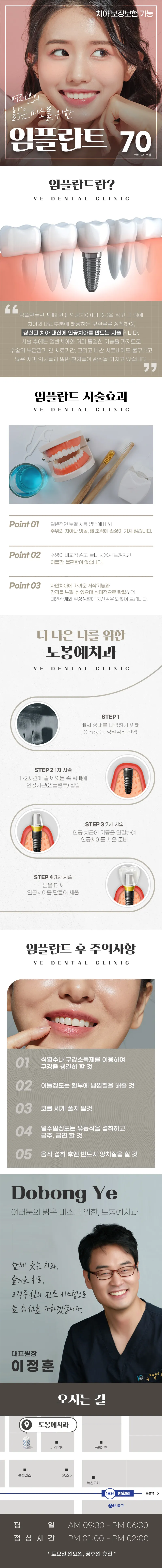 서울리즈치과의원 서울리즈치과_임플란트 이벤트, 시술 상세 이미지