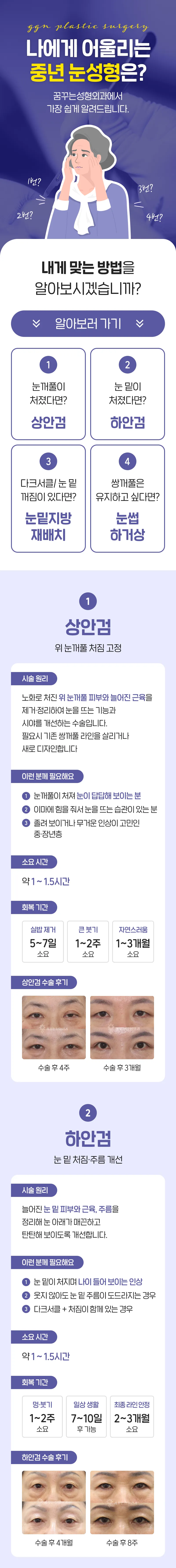 꿈꾸는성형외과의원 [캐시닥단독] 프리미엄 중년 눈성형 이벤트, 시술 상세 이미지