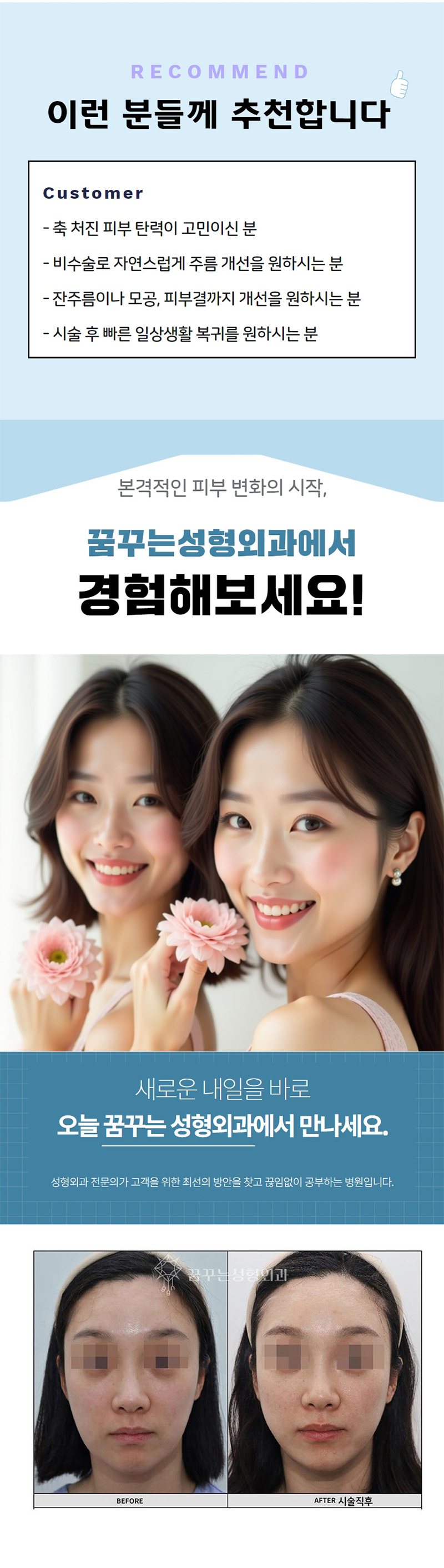 꿈꾸는성형외과의원 세계최초 동시 3파장, 티타늄리프팅  이벤트, 시술 상세 이미지