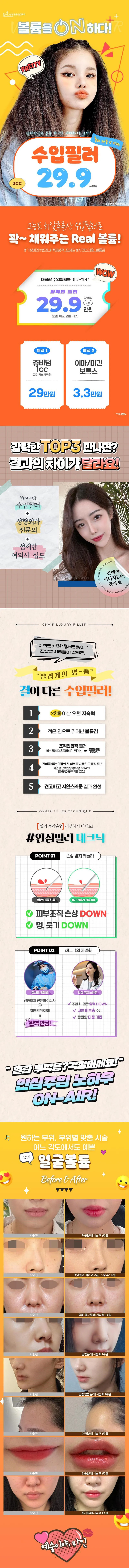 온에어성형외과 온에어 ♥수입필러3CC  이벤트, 시술 상세 이미지