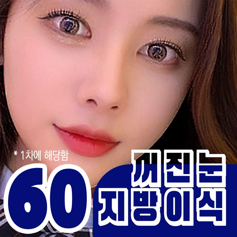 눈꺼풀지방이식 이벤트 썸네일 이미지