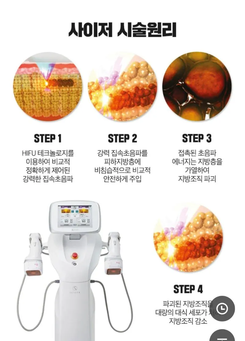 아름다운의원 복부 지방 분해 누워서 편하게 사이져 이벤트, 시술 상세 이미지