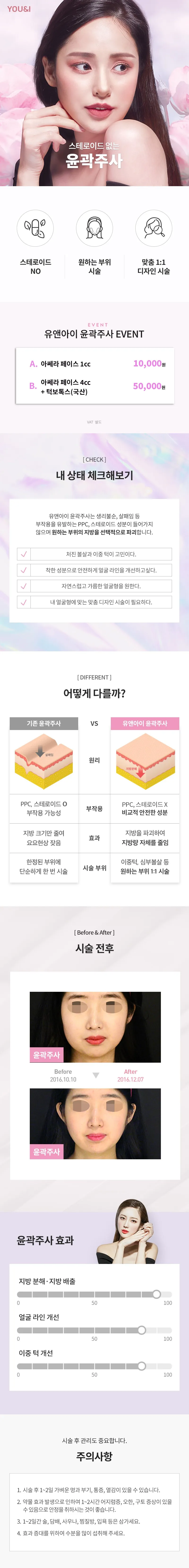 유앤아이의원 영등포점 영등포) v라인 윤곽주사 아쎄라 이벤트, 시술 상세 이미지