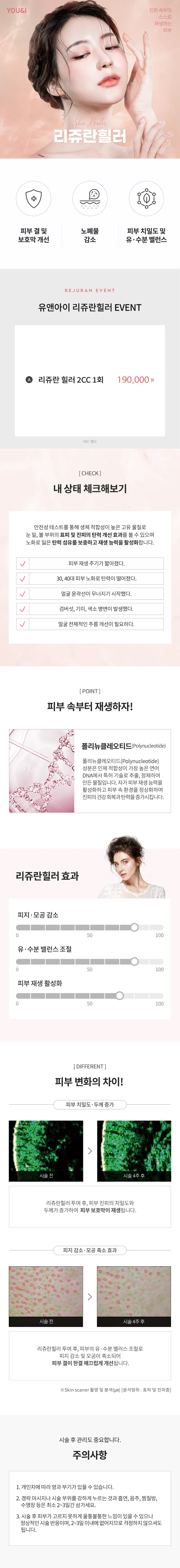 유앤아이피부과의원 판교점 판교) 매끈 피부를 위한 리쥬란힐러 이벤트, 시술 상세 이미지