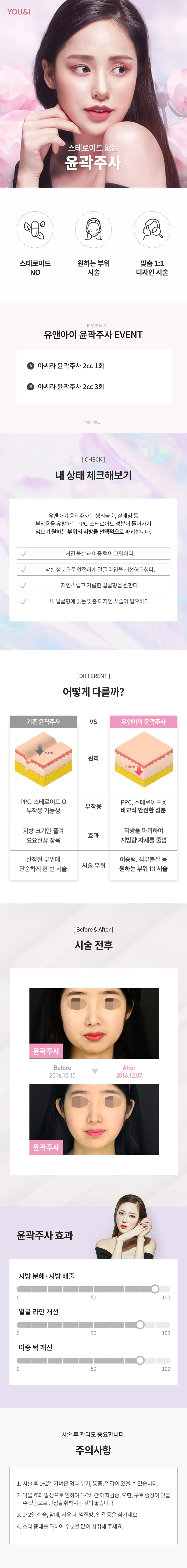 유앤아이의원 광주점 스테로이드 없는 윤곽주사 이벤트, 시술 상세 이미지