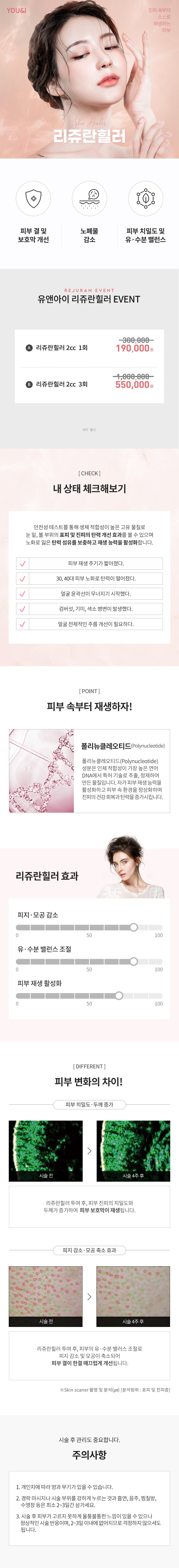 유앤아이의원 천안점 천안) 피부재생 리쥬란힐러 이벤트, 시술 상세 이미지