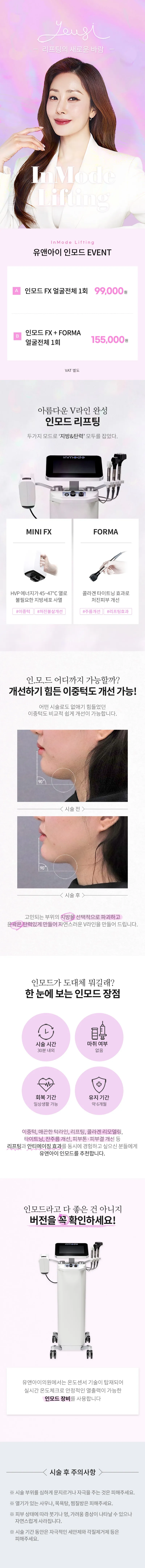 유앤아이의원 다산점 다산) V라인 만드는 인모드 리프팅 이벤트, 시술 상세 이미지