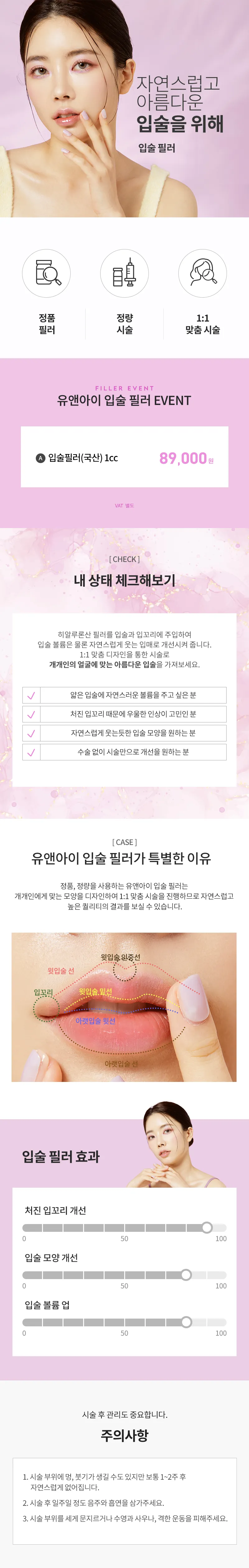 유앤아이의원 다산점 다산) 볼륨 입술 필러 이벤트, 시술 상세 이미지