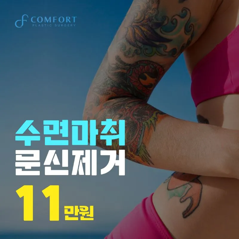 편안한 문신제거 이벤트 썸네일 이미지