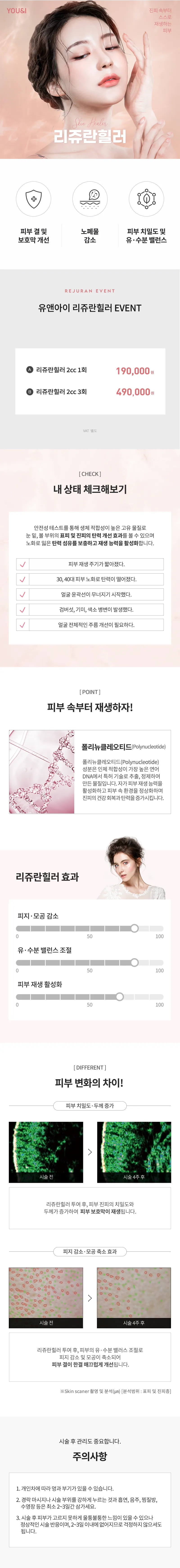 유앤아이의원 대구점 대구) 피부재생 리쥬란힐러 이벤트, 시술 상세 이미지