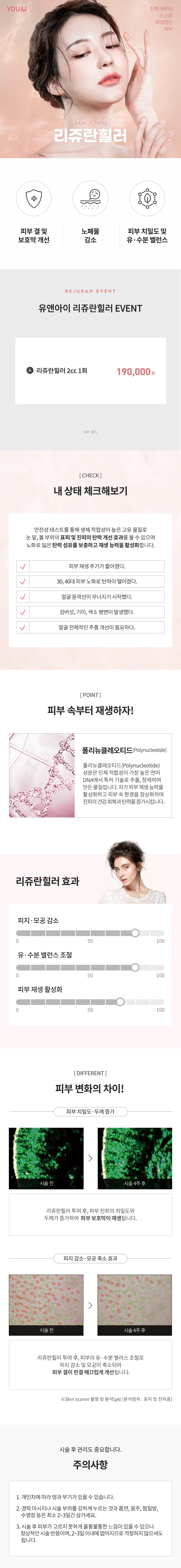 유앤아이의원 대구점 대구) 피부재생 리쥬란힐러 이벤트, 시술 상세 이미지