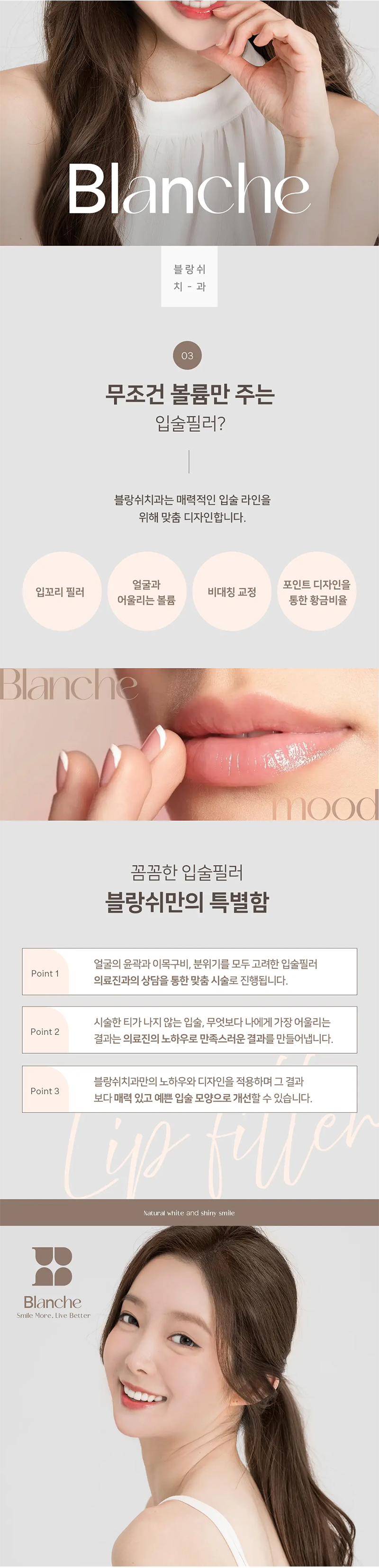 블랑쉬치과 Blanche, 입술 필러 이벤트, 시술 상세 이미지