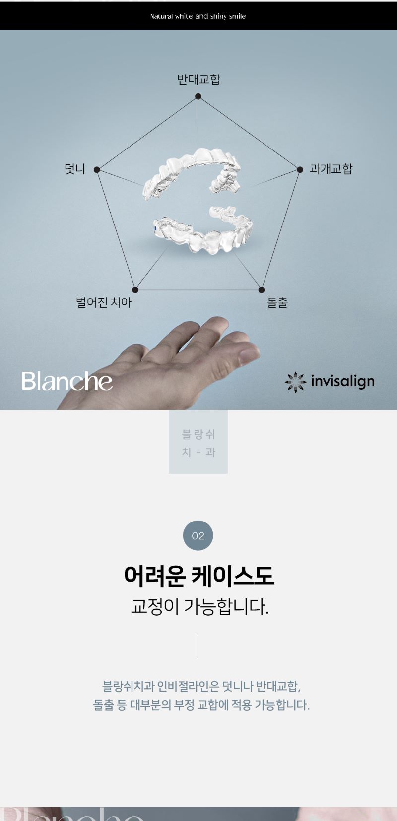 블랑쉬치과 블랑쉬 투명교정 인비절라인 이벤트, 시술 상세 이미지