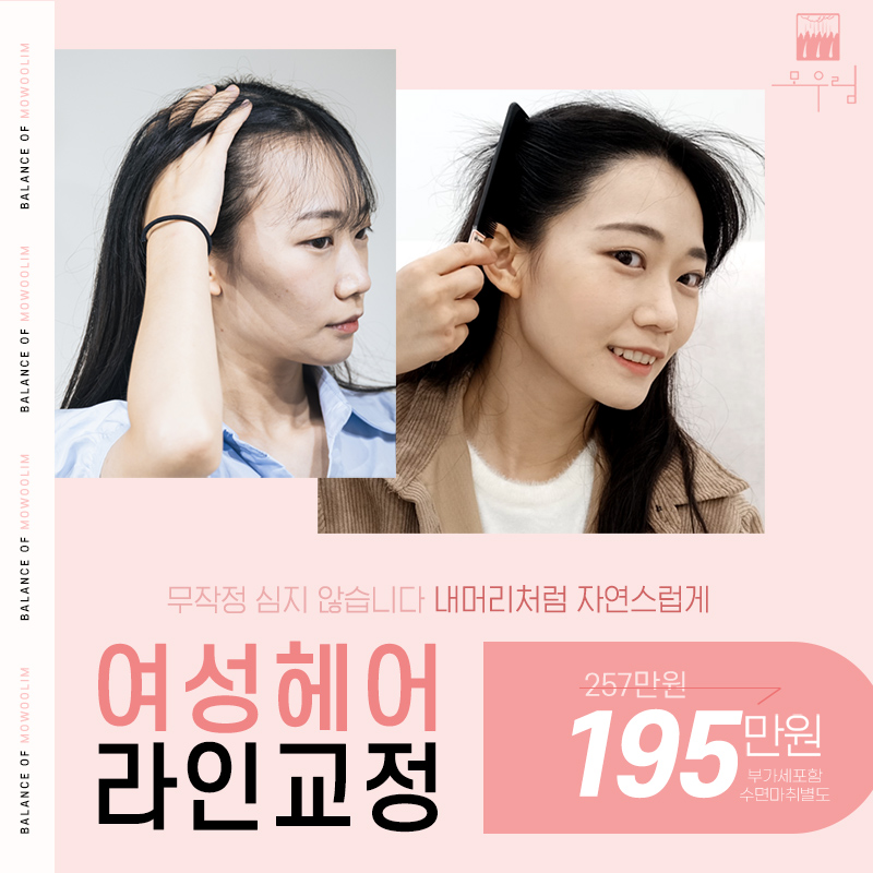 얼굴축소 여성헤어라인 모발이식  이벤트 썸네일 이미지