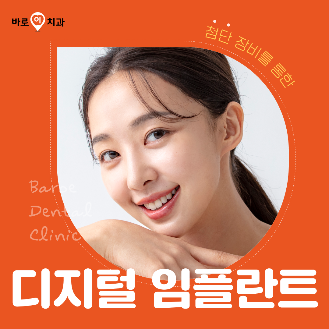 군포 바로이치과) 디지털 임플란트 이벤트 썸네일 이미지