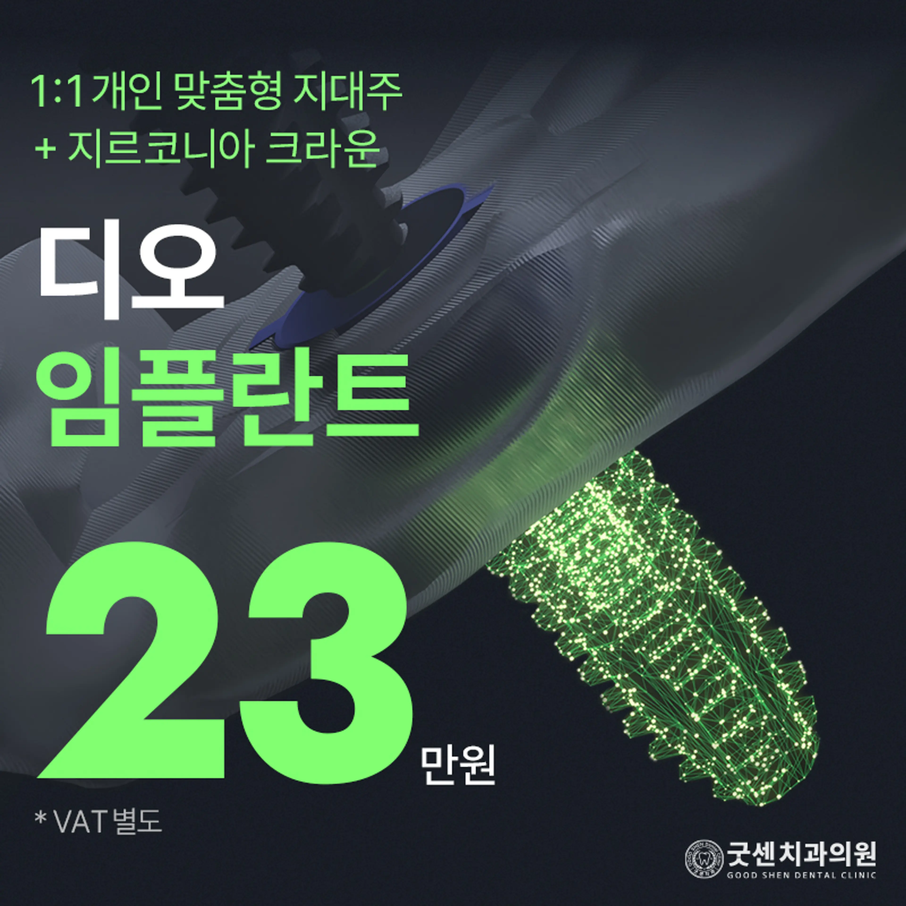 굿센 디오 임플란트