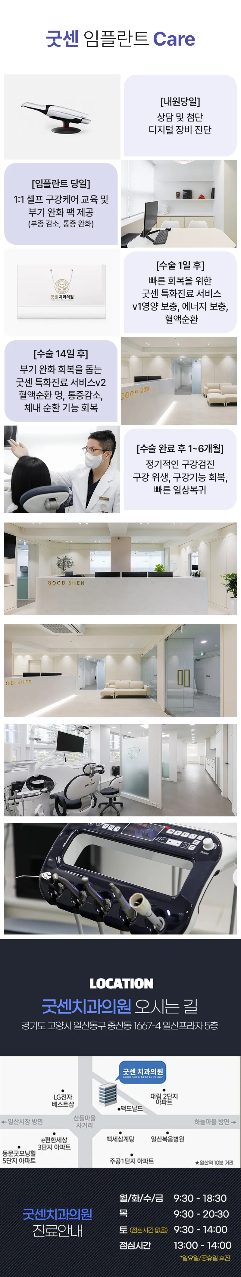 굿센치과의원 굿센 디오 임플란트 이벤트, 시술 상세 이미지