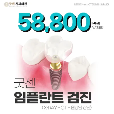 굿센 임플란트 검진 이벤트 썸네일 이미지