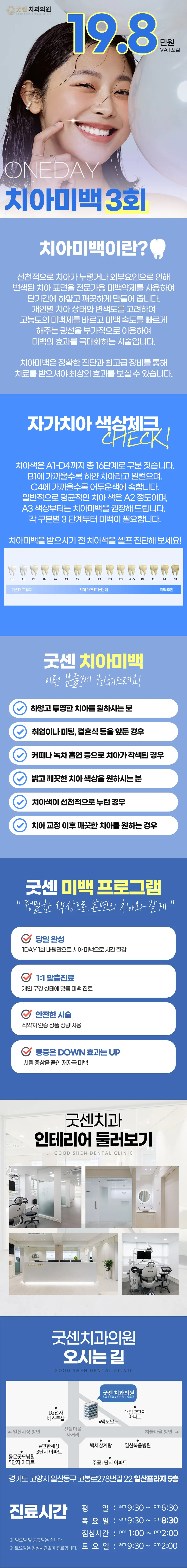 굿센치과의원 당당하게 스마일 원데이 치아미백 3회 이벤트, 시술 상세 이미지