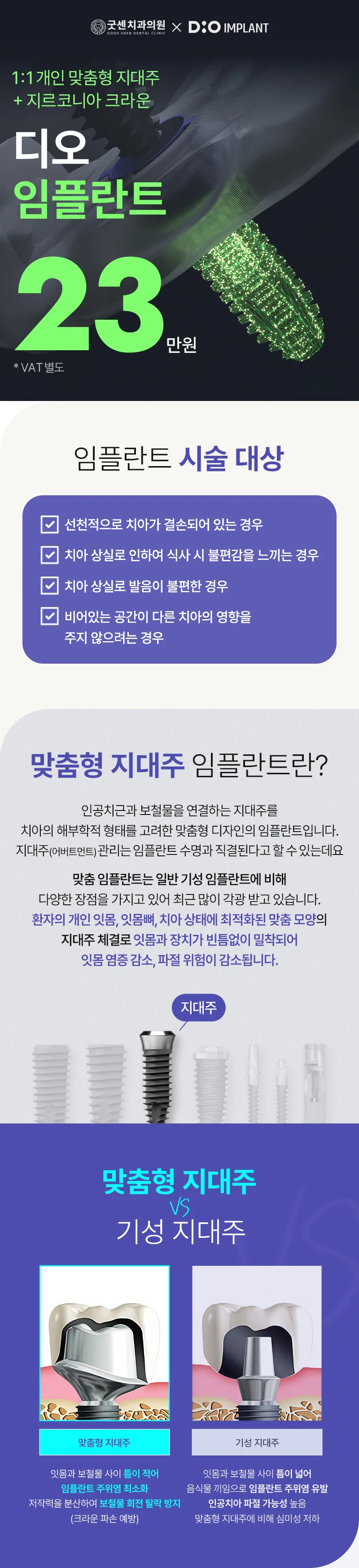 굿센치과의원 굿센 디오 임플란트 이벤트, 시술 상세 이미지