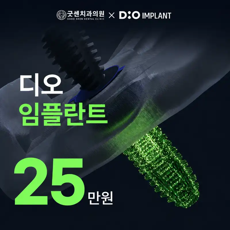 굿센 디오 임플란트