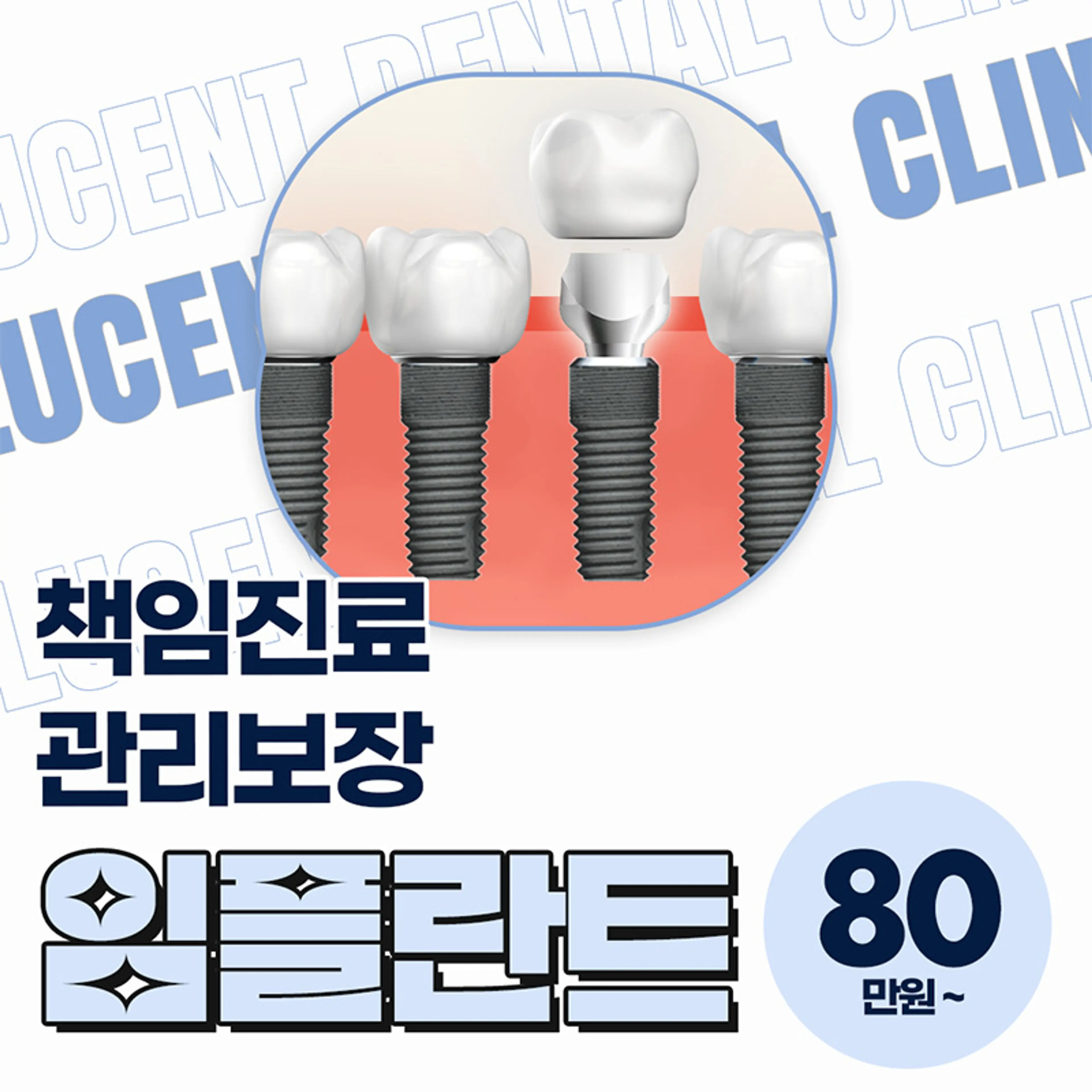 책임진료 관리보장 임플란트