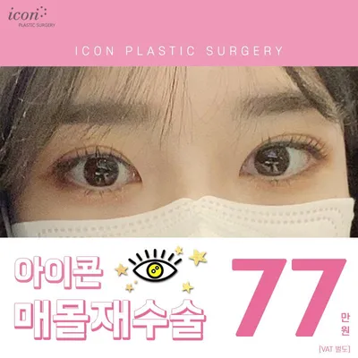 아이콘 매몰재수술 이벤트 썸네일 이미지