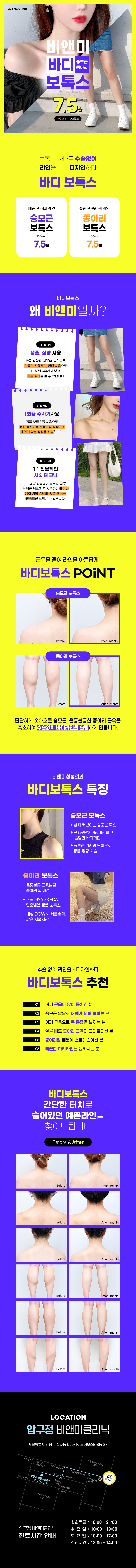 압구정비앤미의원 비앤미  바디보톡스(승모근/종아리)  이벤트, 시술 상세 이미지