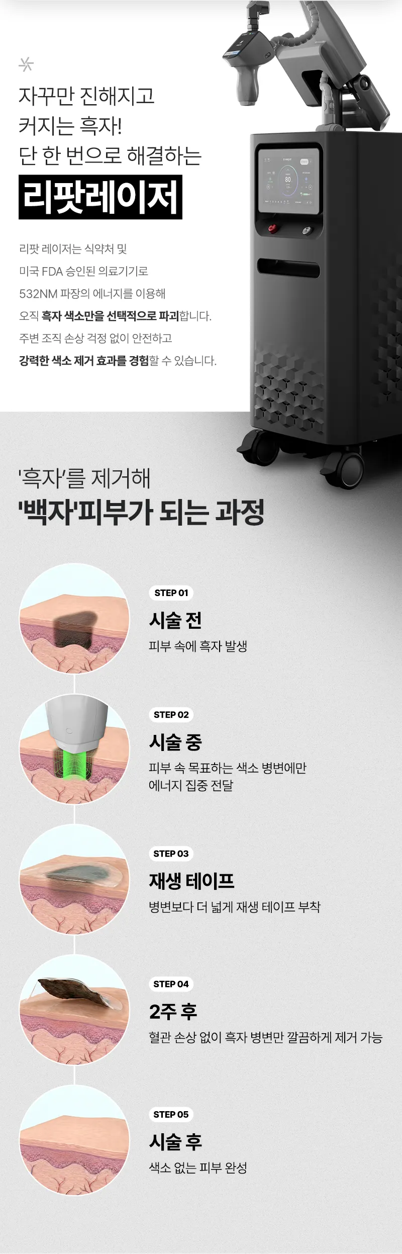 압구정비앤미의원 압구정비앤미  흑자,기미  리팟제거  이벤트, 시술 상세 이미지
