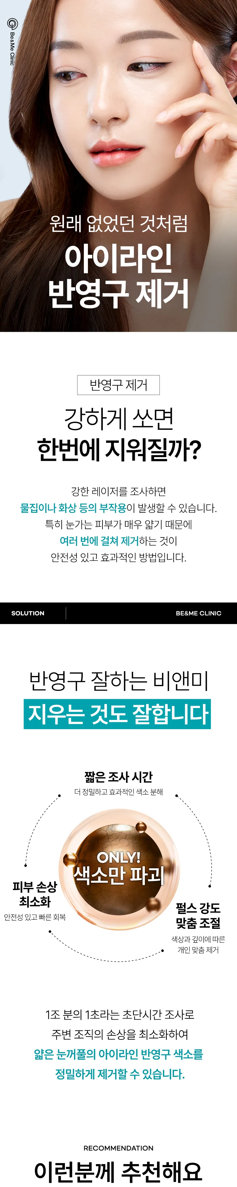 압구정비앤미의원 비앤미 아이라인 반영구 문신제거 이벤트, 시술 상세 이미지