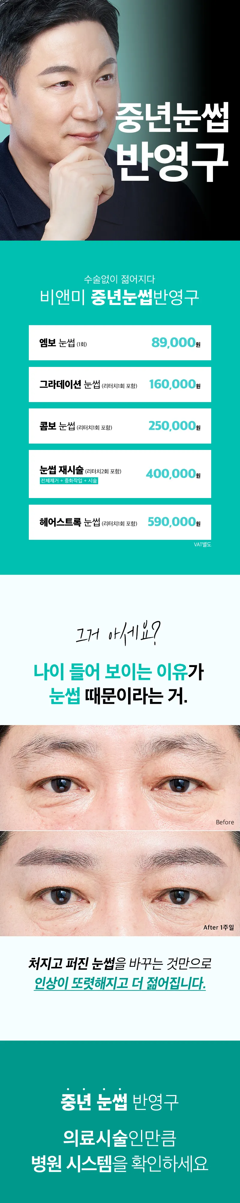 압구정비앤미의원 중년눈썹반영구도 비앤미에서 이벤트, 시술 상세 이미지