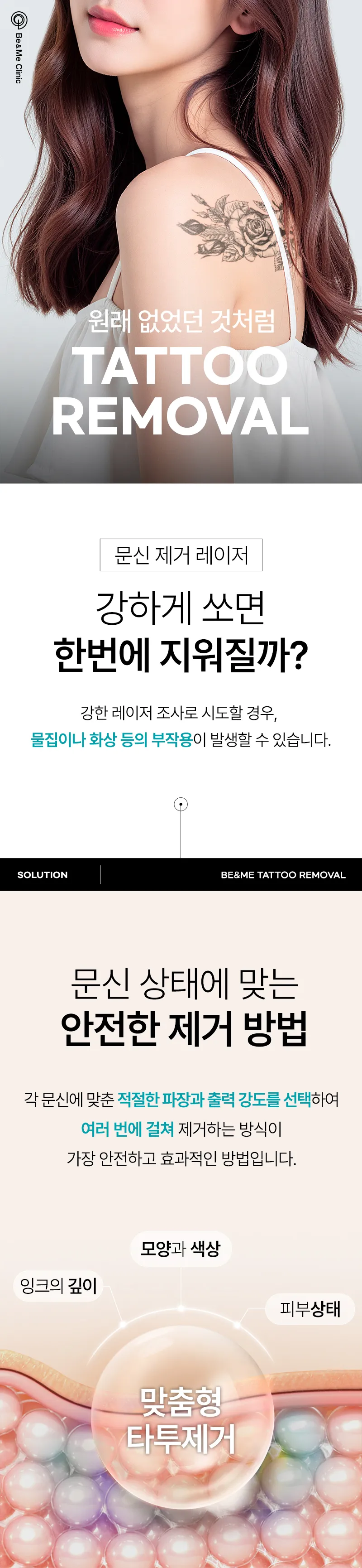 압구정비앤미의원 비앤미  타투 · 문신제거 깔끔하게  이벤트, 시술 상세 이미지