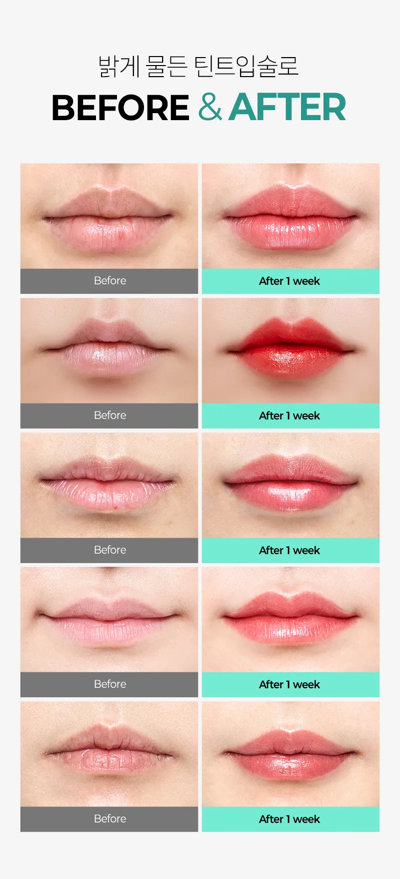 압구정비앤미의원 비앤미 생기있는 입술 반영구 이벤트, 시술 상세 이미지