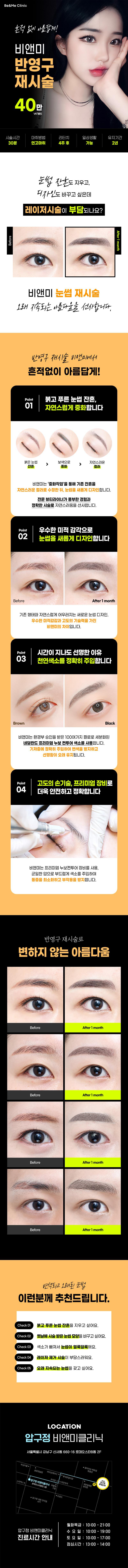압구정비앤미의원 비앤미 반영구 재시술 이벤트, 시술 상세 이미지