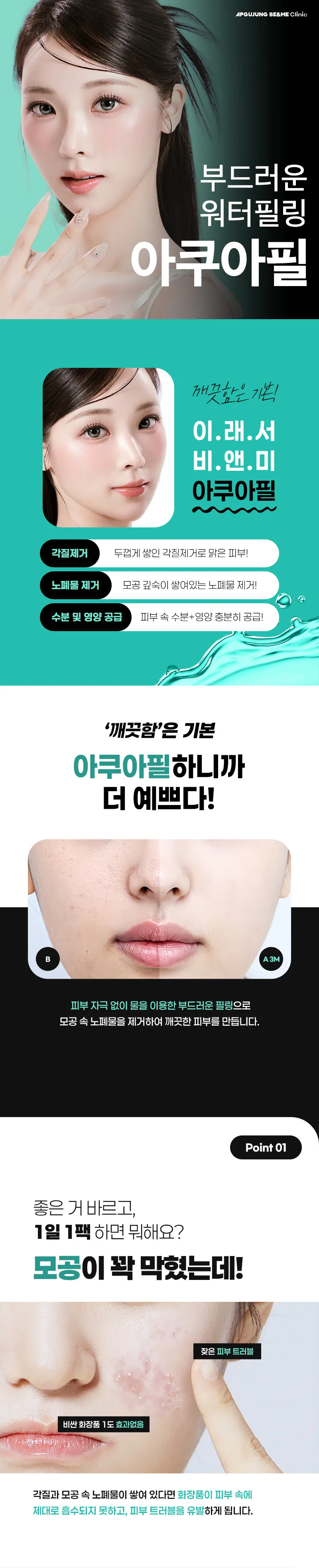 압구정비앤미의원 비앤미 모공·피지 아쿠아필 이벤트, 시술 상세 이미지