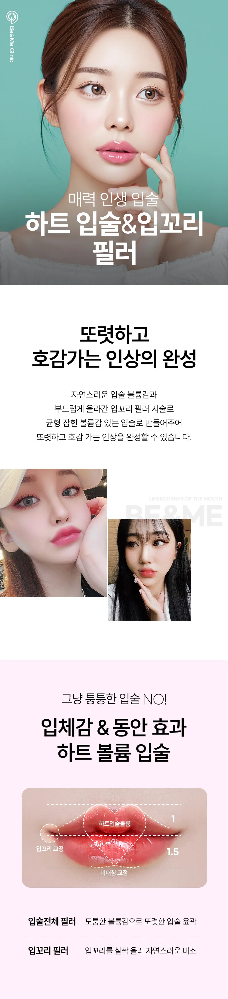 압구정비앤미의원 비앤미 입꼬리까지 완성되는 입술필러 이벤트, 시술 상세 이미지