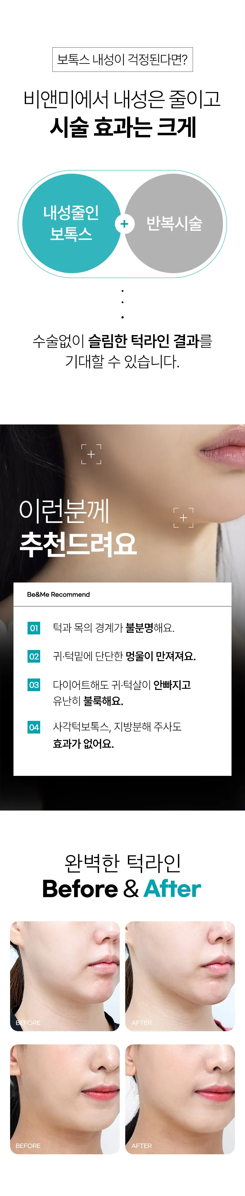 압구정비앤미의원 요즘대세 비앤미침샘보톡스 턱라인정리  이벤트, 시술 상세 이미지