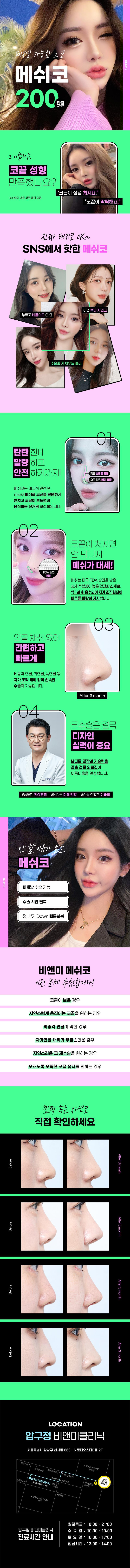 압구정비앤미의원 비앤미 메쉬코 200만 이벤트, 시술 상세 이미지