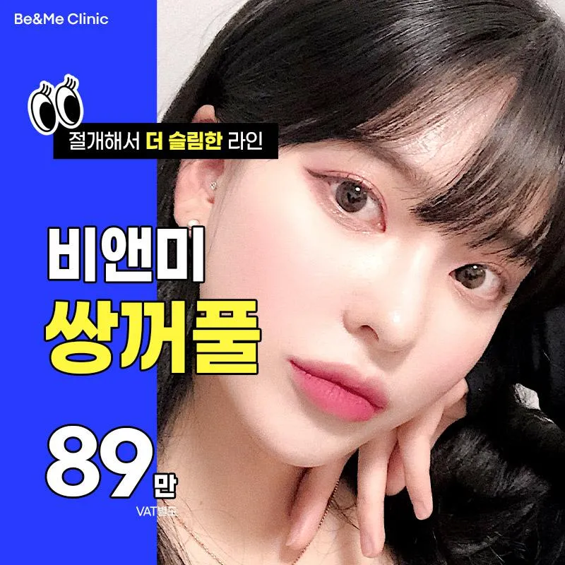 비앤미 쌍꺼풀 89만 이벤트 썸네일 이미지