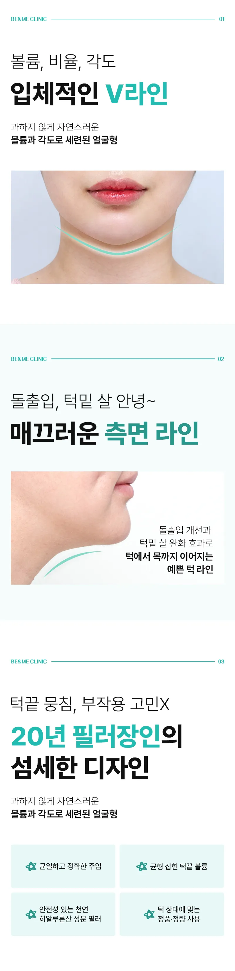 압구정비앤미의원 비앤미 앞턱 V필러 이벤트, 시술 상세 이미지