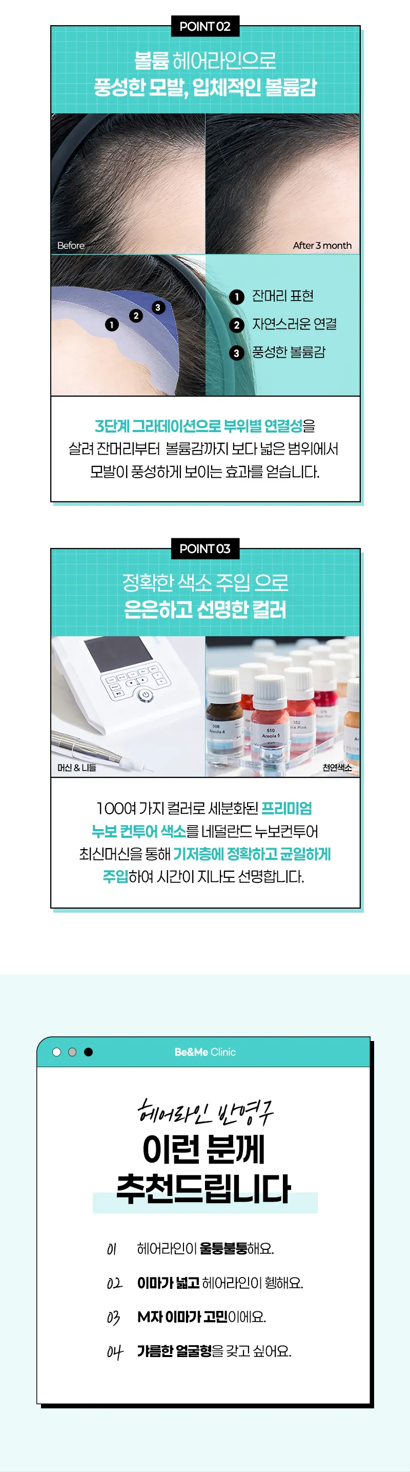 압구정비앤미의원 비앤미 헤어라인 반영구 - 리터치포함 이벤트, 시술 상세 이미지