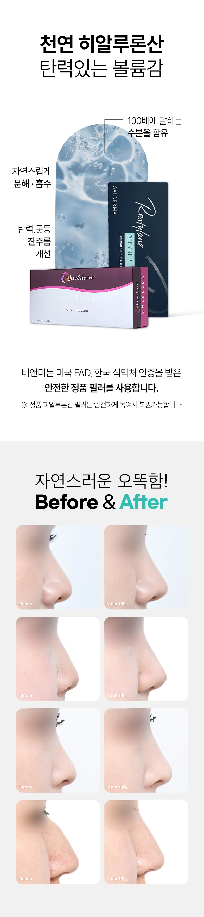 압구정비앤미의원 비앤미 자연스러운 코필러  이벤트, 시술 상세 이미지