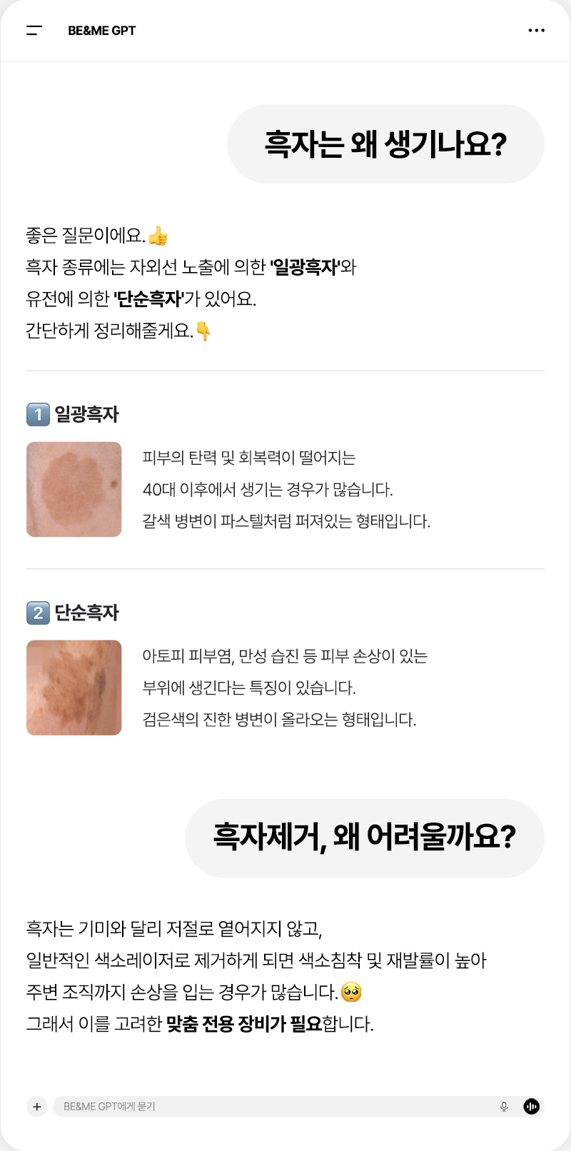 압구정비앤미의원 압구정비앤미  흑자,기미  리팟제거  이벤트, 시술 상세 이미지