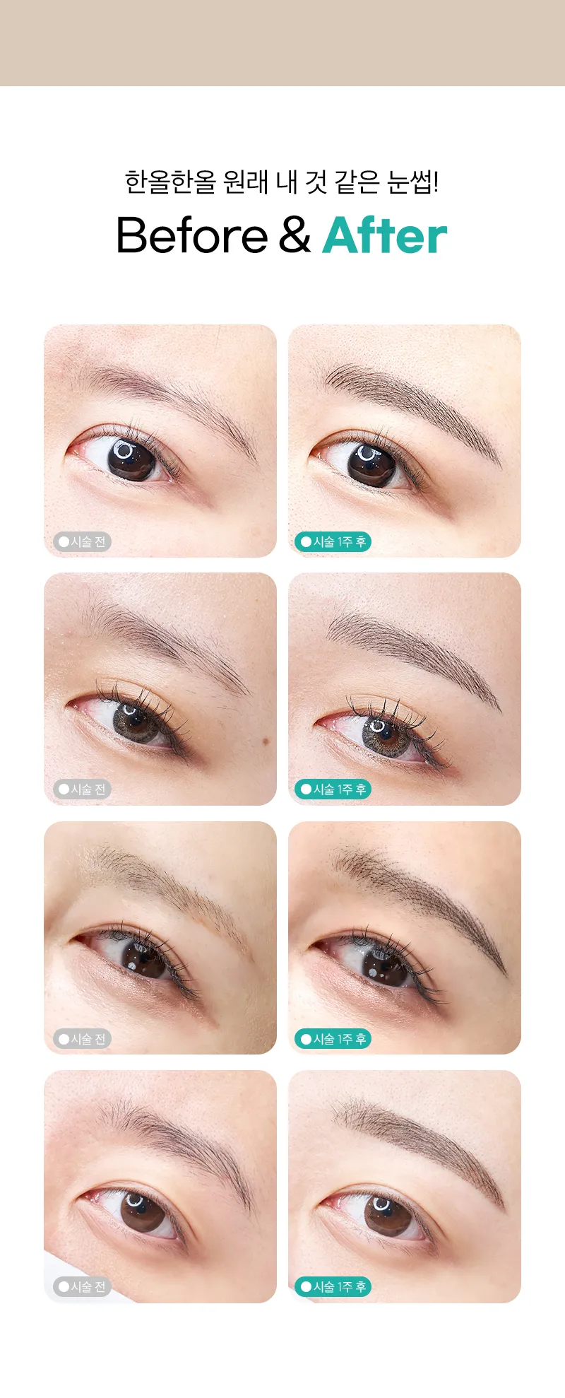 압구정비앤미의원 원래 내 것처럼 비앤미 눈썹 반영구 이벤트, 시술 상세 이미지